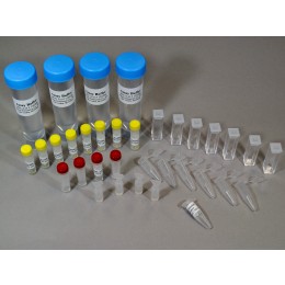 Nitrate Test Kit by NADH Disappearance: 100 Sample Analysis